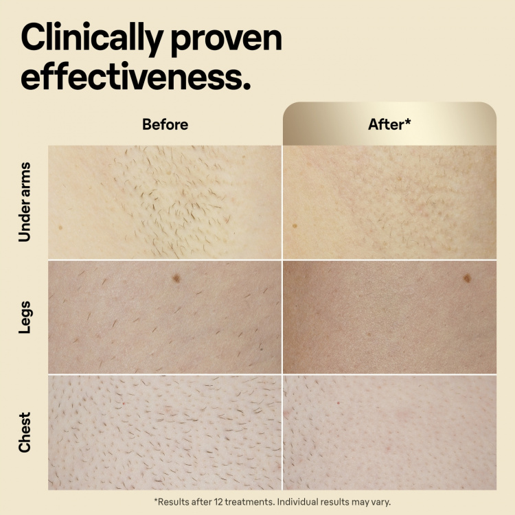 Braun IPL Silk-expert Pro 5 PL5242 IPL-apparat